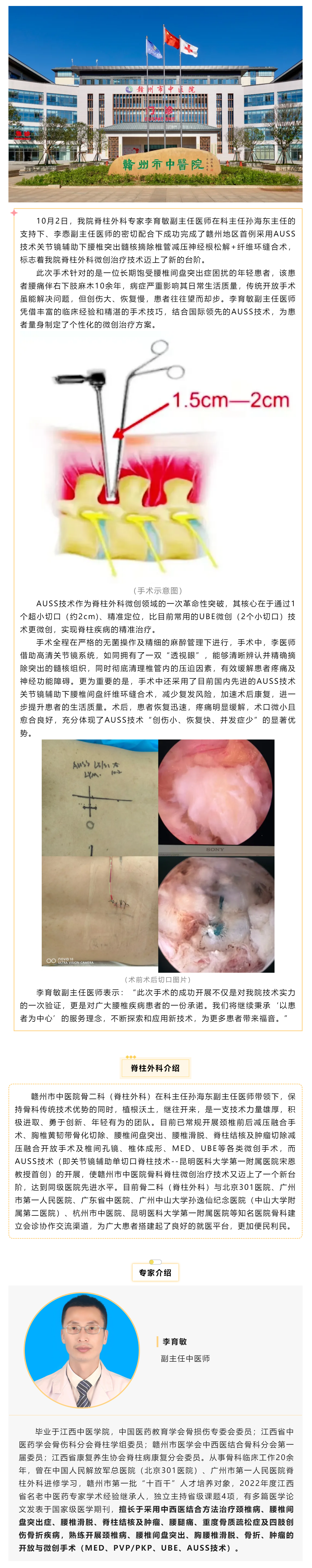 全市首例！我院成功實(shí)施AUSS技術(shù)關(guān)節(jié)鏡輔助下腰椎突出髓核摘除椎管減壓神經(jīng)根松解+纖維環(huán)縫合術(shù).png