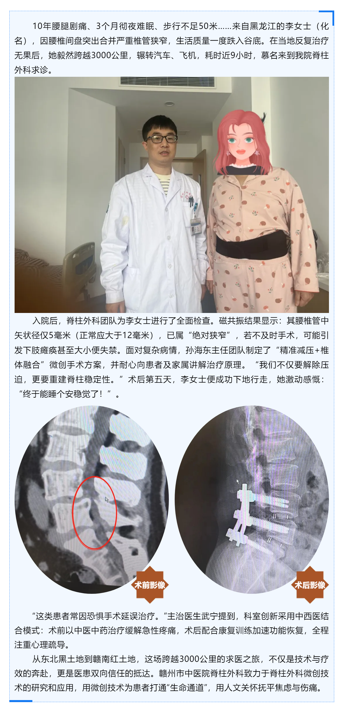 跨越山河的信任_贛州市中醫(yī)院巧手“疏堵”，腰椎狹窄患者3000公里求醫(yī)路終迎新生！.png